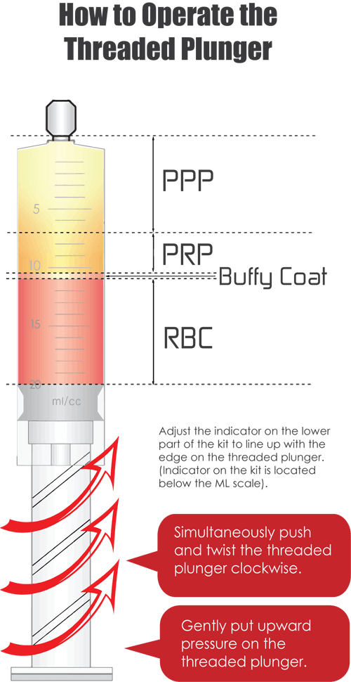 YES PRP Kit Threaded Plunger
