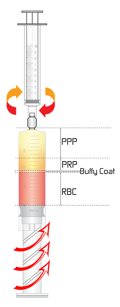 YES PRP Kit PPP, PRP, Buffy Coat and RBC Graphic