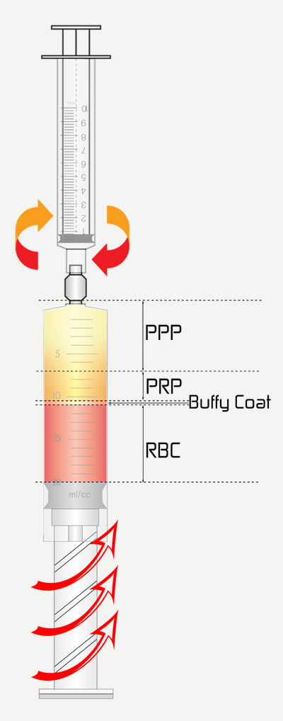Yes PRP Kit Advantages - PPP, PRP, Buffy Coat and RBC Illustration